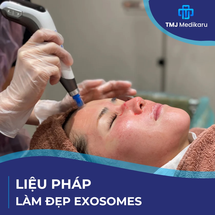 Liệu pháp Exosomes – Bí Quyết Trẻ Hóa Da Từ Công Nghệ Y Học Tái Sinh