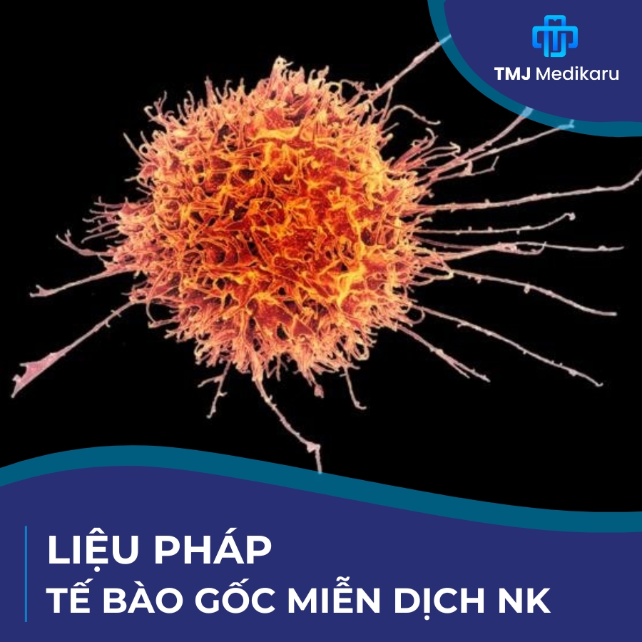 Liệu pháp tế bào gốc miễn dịch NK