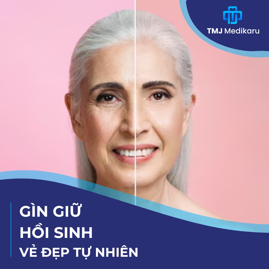 Anh thumbnail bai viet vuong